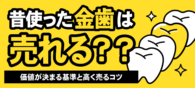 昔使った金歯は売れる？？ 価値が決まる基準と高く売るコツ